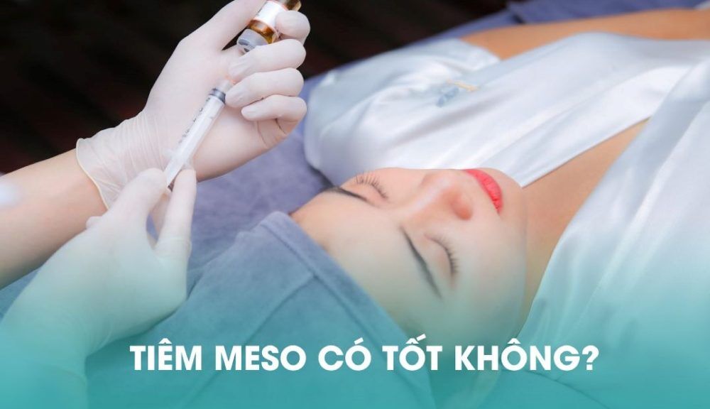 Có nên tiêm meso không? Tiêm meso có tốt không?